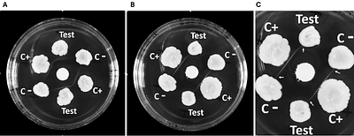 Modified Elek test improves in-vitro detection of diphtheria toxin