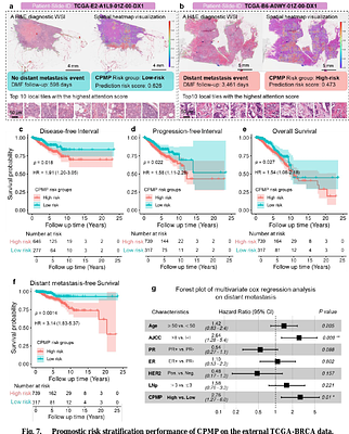 AI-driven computational pathology for recurrence risk assessment in early-stage breast cancer