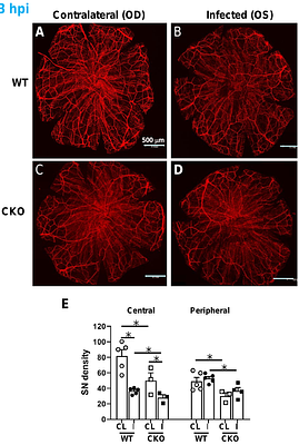 New Insight Into the Neuroimmune Interplay In Pseudomonas aeruginosa Keratitis