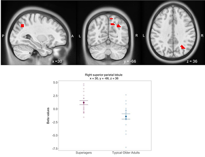 Hippocampal and Midbrain Function in Superagers Relates to Memory for Novelty and Expectation Violation