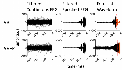 Forecast Padding Enhances Accuracy and Robustness of EEG-Phase-Synchronized TMS