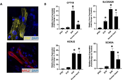 Advanced Cardiac Organoid Model for Studying Doxorubicin-Induced Cardiotoxicity