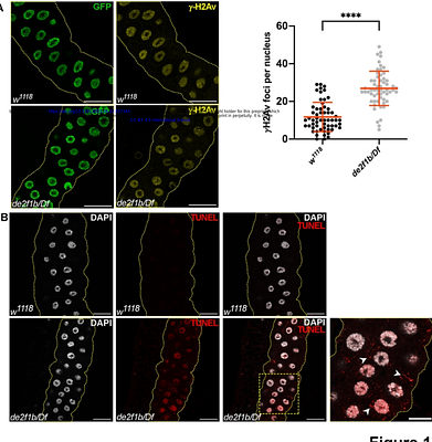 E2F deregulation compromises ER homeostasis by attenuating IRE1 activity