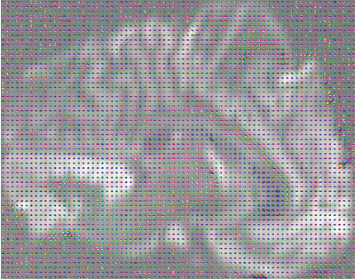 Spatial Image Gradient Estimation from the Diffusion MRI Profile