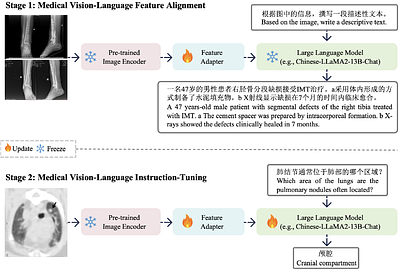 Qilin-Med-VL: Towards Chinese Large Vision-Language Model for General
  Healthcare