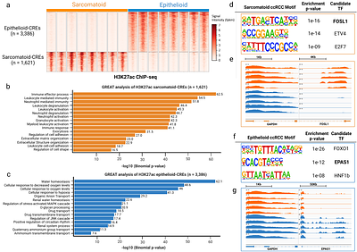 Epigenomic signatures as circulating and predictive biomarkers in sarcomatoid renal cell carcinoma