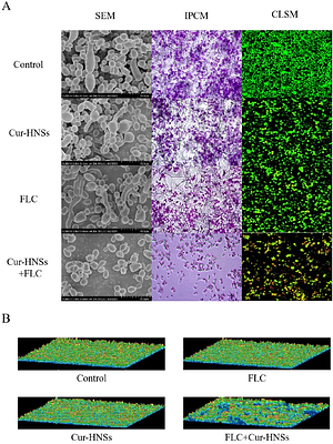 Nanotechnology-Driven Synergy: Research Effects of Curcumin Nanosuspension and Fluconazole Combination in Overcoming Azole Resistance in Candida Albicans