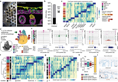 Modeling host-microbe interactions in immunocompetent engineered human gut tissues