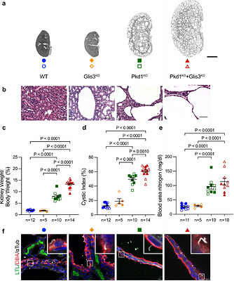 Glis3 is a modifier of cyst progression in autosomal dominant polycystic kidney disease