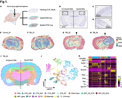 OmicGlaze: Spatial Multi-Omic Mapping of Traumatic Brain Injury