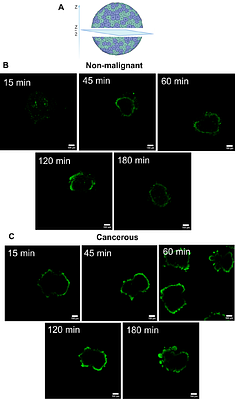 Development of a liposomal formulation of a TKI: the active loading of erlotinib.HCl