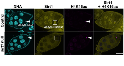 Meiotic cohesion requires Sirt1 and preserving its activity in aging oocytes reduces missegregation