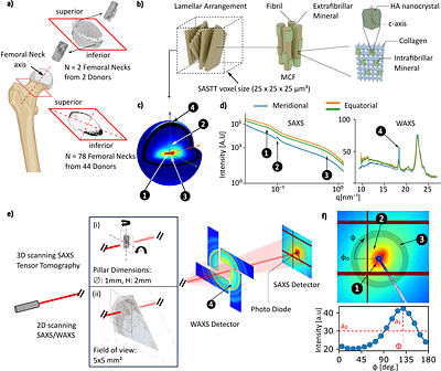 Combination of 3D and 2D small and wide angle X-ray scattering imaging reveals diminished bone quality in the superior human femoral neck cortex