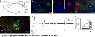 Electrophysiological properties of mesodiencephalic junction neurons projecting to the inferior olive