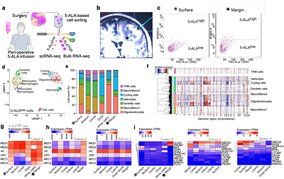 Multi-region biopsies and patient-derived neurosphere cultures reveal spatial divergence in glioblastoma.