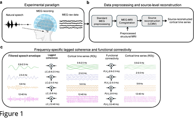 Slow-Rate Temporal Sampling Deficits During Naturalistic Speech Listening in Children with Developmental Language Disorder