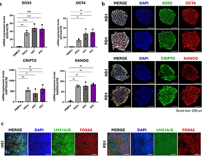 Rare variants alter mitochondrial lipid homeostasis and neuronal excitability in PD patient-derived dopaminergic neurons