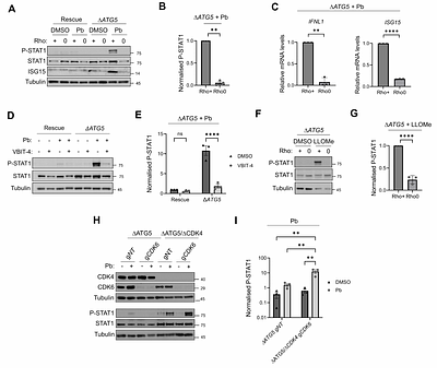 Chronic lysosome damage boosts interferon responses to Palbociclib through a mitochondrial signalling axis