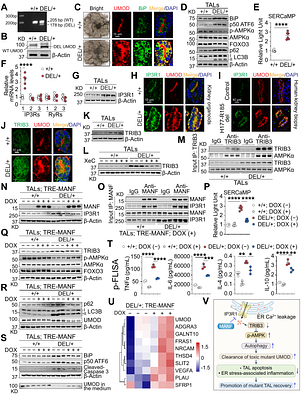 MANF Clears Mutant Uromodulin in Human Kidney Organoids of Autosomal Dominant Tubulointerstitial Kidney Disease