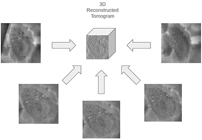 Robust Deep Denoising of Soft X-Ray Tomography Data for Biological Research: Targeting Tilt Series Versus Reconstructed Tomograms