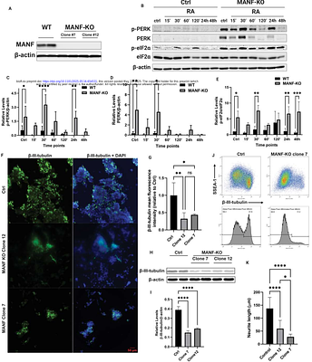 Alcohol Disrupts Neural Differentiation Through Endoplasmic Reticulum Stress and PERK Pathway Activation