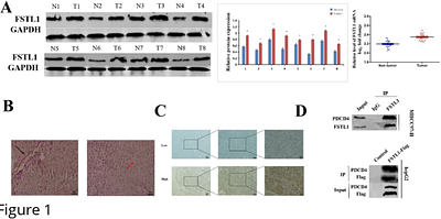 Follistatin-like protein 1 interacts with programmed cell death 4 to promote vascular mimicry in hepatocellular carcinoma by activating the PI3K/AKT/mTOR signaling pathway