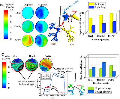 A combined Eulerian-Lagrangian and thin film approximation model to investigate the disease-specific drug delivery efficacy on realistic lung geometry and breathing profiles