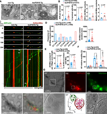 Dysregulation of a novel autophagosome-mitochondria contact contributes to autophagy dysfunction and neurodegeneration in tauopathy
