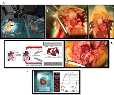 Mechanical unloading coupled with coronary reperfusion reduces fibrosis and stimulates cardiomyocyte proliferation after myocardial infarction