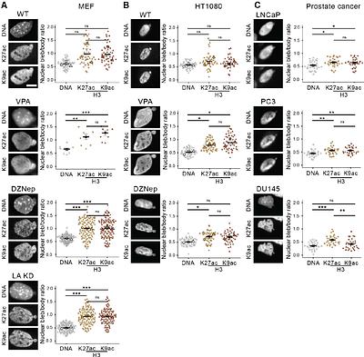Nuclear blebs are composed of variable chromatin states but consistently enrich transcription initiation relative to elongation