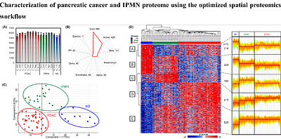 High-Sensitive Spatial Proteomics for Pancreatic Cancer Progression Analysis