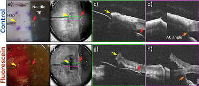 Optical Coherence Tomography with Fluorescein Optical Clearing for Transscleral Image Guidance