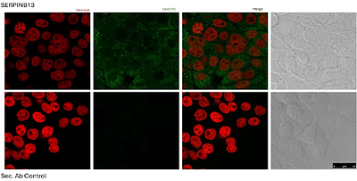 SERPINB13 is a prognostic biomarker for LUSC associated with an immune-inflamed tumor phenotype and modulated by immune cells