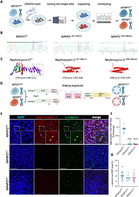 Loss of nephronophthisis-associated nephrocystin-1 impairs DNA damage repair in kidney organoids